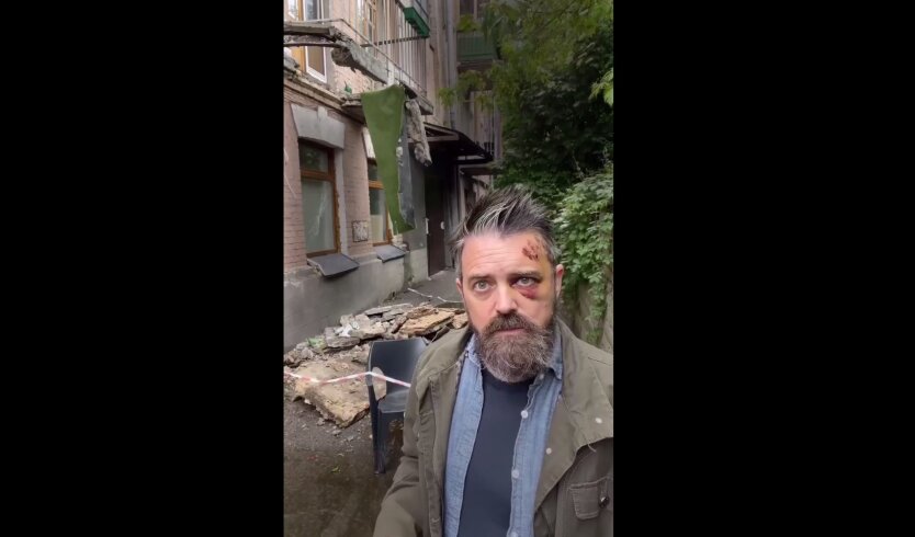 В Киеве упал балкон, пострадал режиссер из США: эксперт объяснил, как столицу довели до коммунальной катастрофы